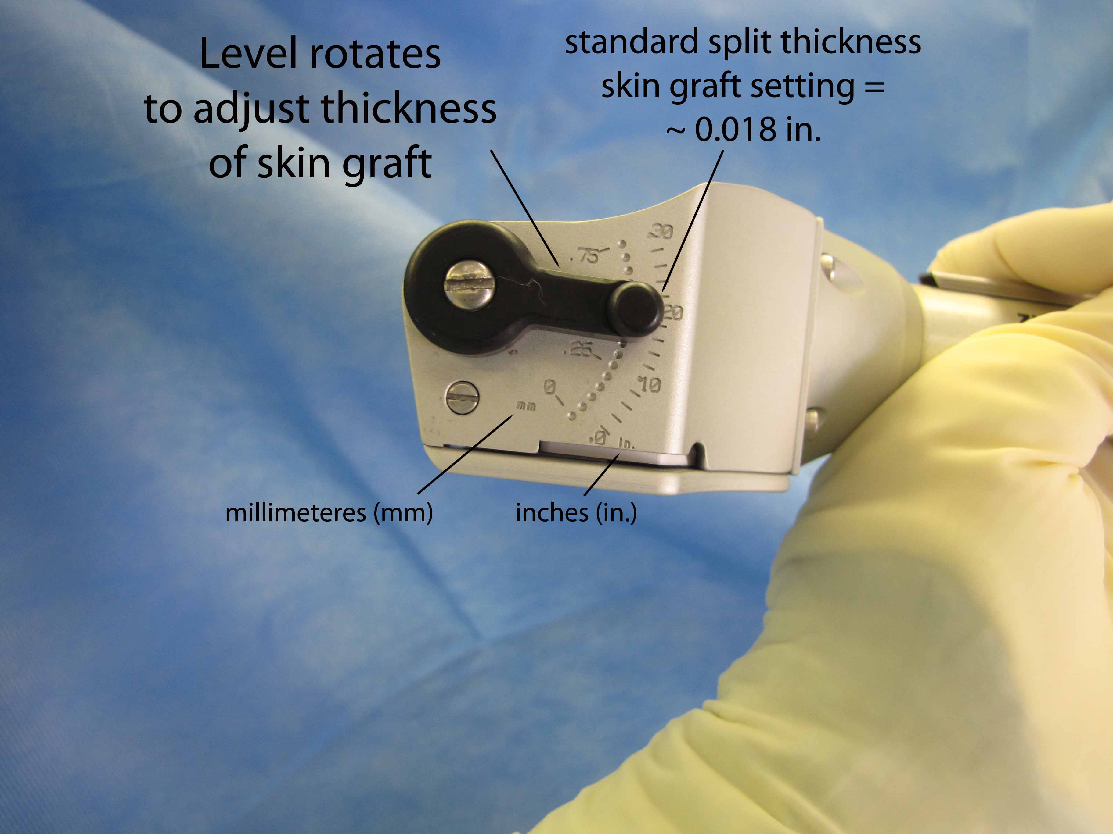 Split Thickness Skin Graft STSG Zimmer Dermatome Settings Clinical split-thickness-skin-graft-stsg-zimmer-dermatome-settings-clinical